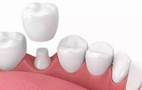 牙齿整形与皮肤美容 三种方式的价格详解